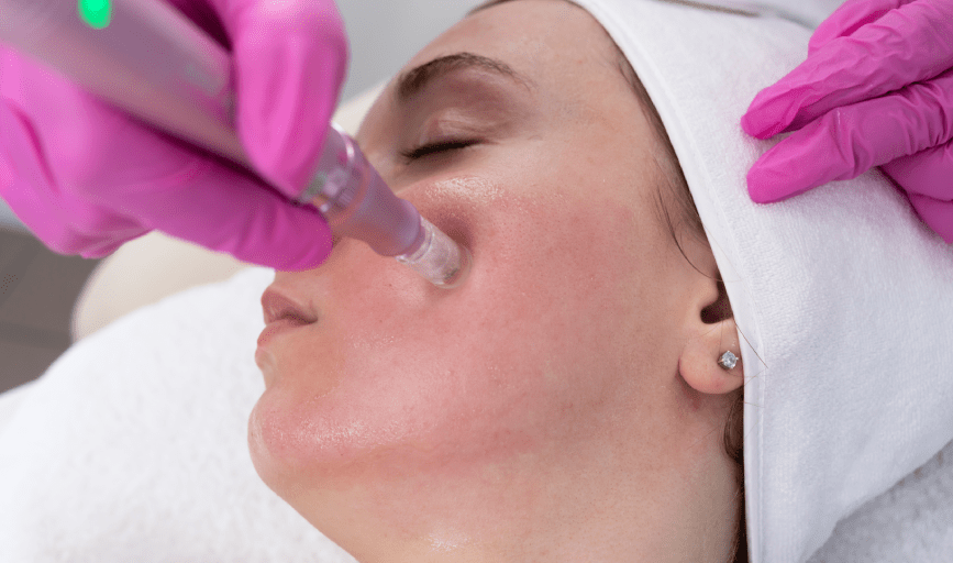 <p style="font-family: 'Poppins', sans-serif; font-weight: 700; font-size:24px;">VAMPIRE FACIAL SERVICE</p>